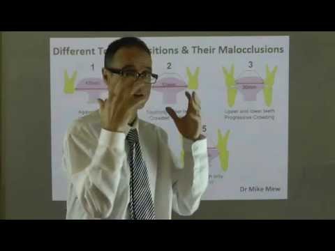 Effect of Tongue Positions on Teeth Alignment, Dental Arch, Lip Shape & Face by Dr Mike Mew