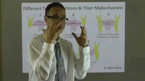 Effect of Tongue Positions on Teeth Alignment, Dental Arch, Lip Shape & Face by Dr Mike Mew