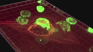 Quels sont les facteurs à l'origine d'un cancer ?