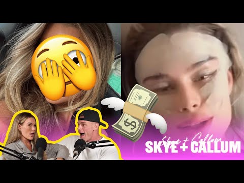 Skye Sutton: The Aftermath Of A Devastating Leak