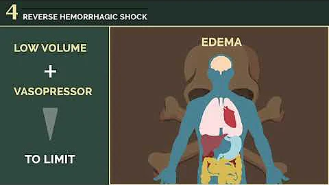 Ep. 3. Damage control resuscitation
