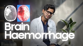 Can Brain Haemorrhage Be Fatal? Understanding Causes & Risks | Dr Atmaranjan Dash