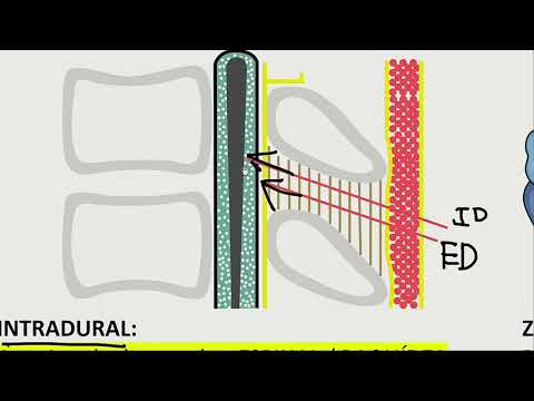 Video: ¿Cuándo fue la primera anestesia neuroaxial?