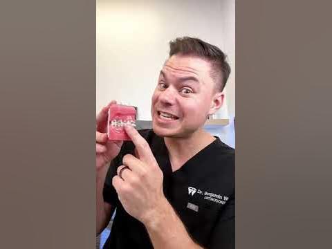 Braces VS KitKat - YouTube
