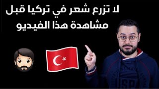 لا تزرع شعر في تركيا قبل مشاهدة هذا الفيديو!! نصائح هامة + تجربتي الشخصية