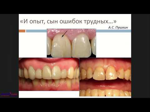 Video: Tipy Na Udržanie Bielych Zubov