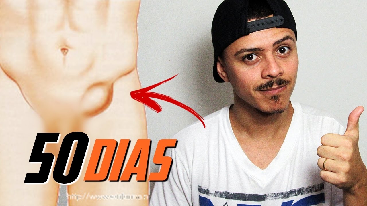 Saiba Tudo Sobre A Cirurgia Videolaparoscopica Da Hernia Inguinal