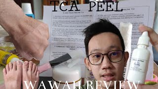 TCA PEELING 20% SENDIRI DIRUMAH | SOLUSI KULIT BELANG, MENGANGKAT KULIT MATI | WORTH IT!
