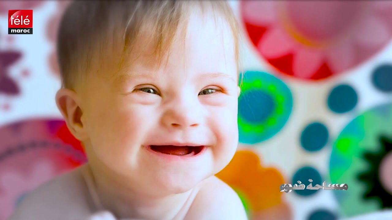 مساحة ضوء: أطفال الثلاثي الصبغي في المغرب بين إكراهات الإعاقة وضرورة التكفل الطبي