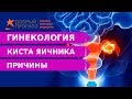 ПРИЧИНЫ кисты яичника. ОТВЕТ В ВИДЕО!