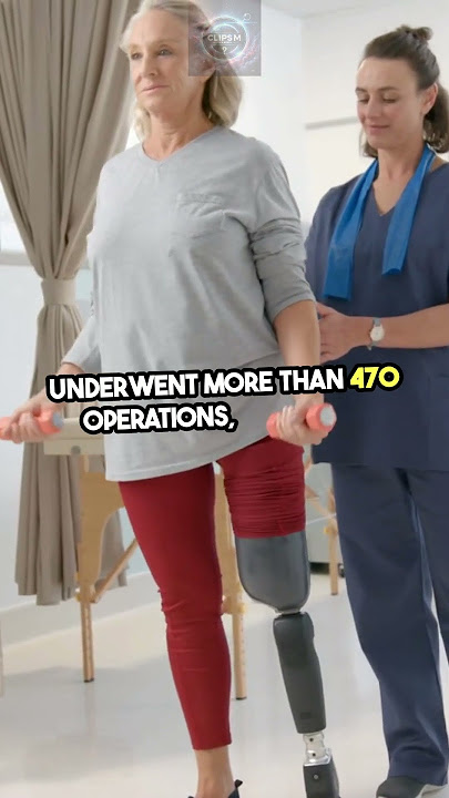 Download lagu The Man Who Survived Over 470 Surgeries | Charles Jensen’s Record Explained