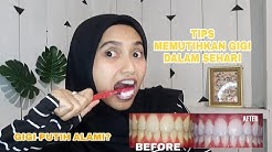 Cara memutihkan gigi di rumah dalam 3 menit - Nia Agustini - Durasi: 5.34. 
