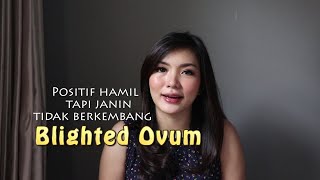 Blighted Ovum - Hamil tapi Kosong