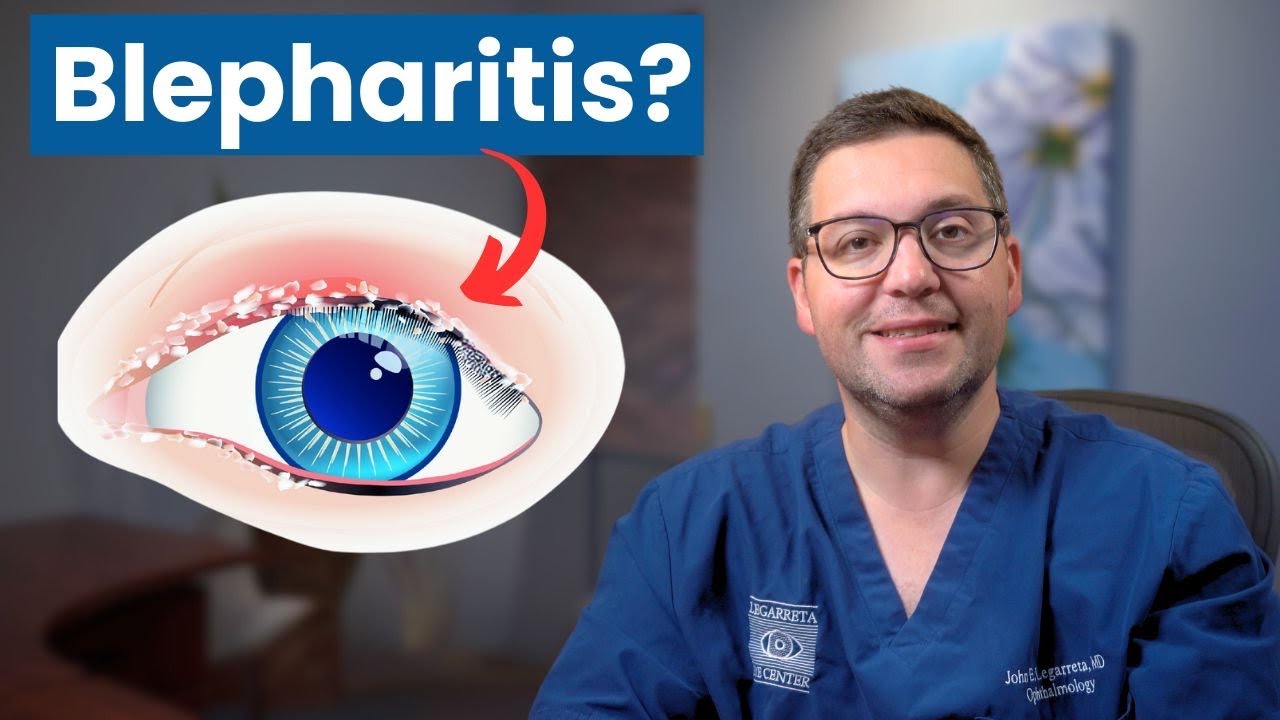 Easy Home Remedies For Blepharitis MGD Relief YouTube easy-home-remedies-for-blepharitis-mgd-relief-youtube