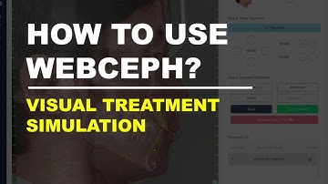 How to use WEBCEPH: Visual Treatment Simulation