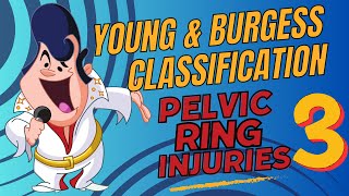 OrthoConcepts - Radiographic Evaluation of Young and Burgess Classification of Pelvic Fractures