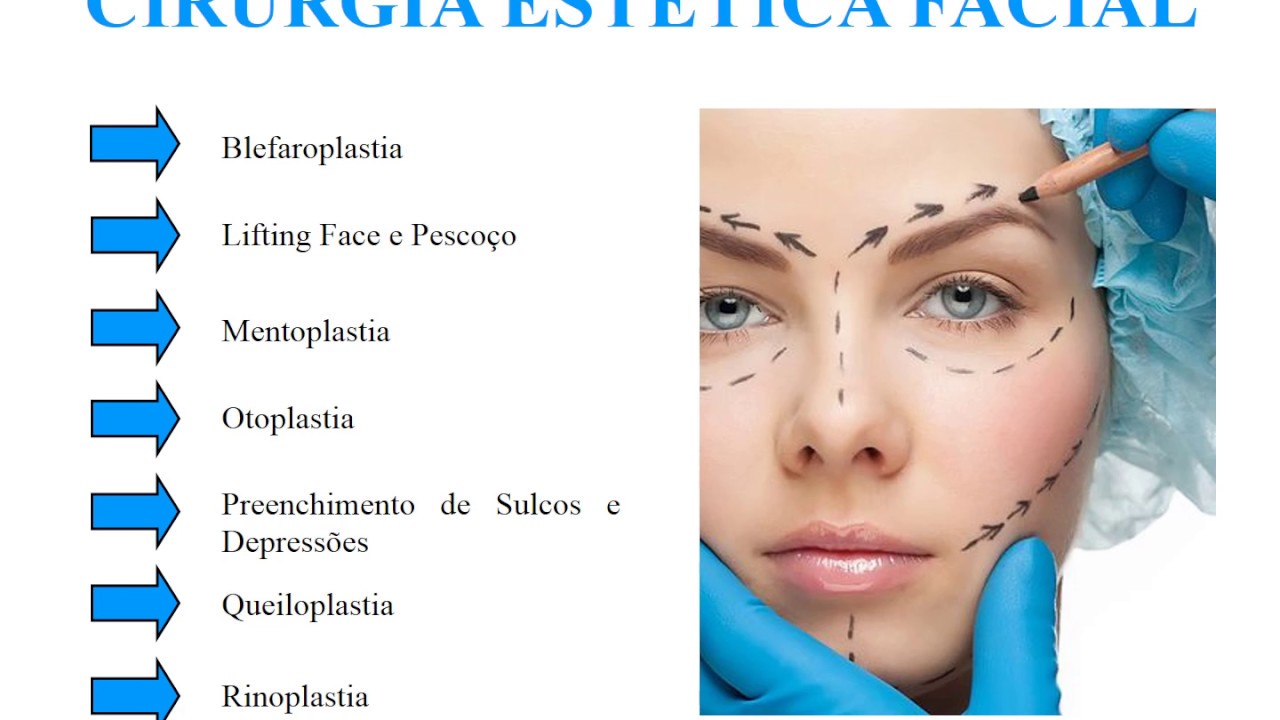 Cirurgia MaxFac - Cirurgia Maxilo Facial