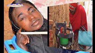 Eşi Benzeri Görülmemiş - 19 Yıldır Plastik Leğende Yaşıyor - The Girl Who Lives In A Bowl