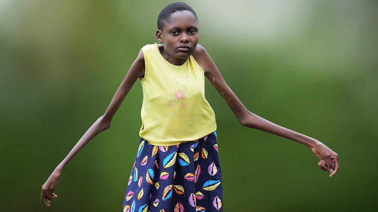 Umukobwa Muto Cyane Kwisi Araturijije Twari Tuzi Ko Yapfuye umukobwa-muto-cyane-kwisi-araturijije-twari-tuzi-ko-yapfuye