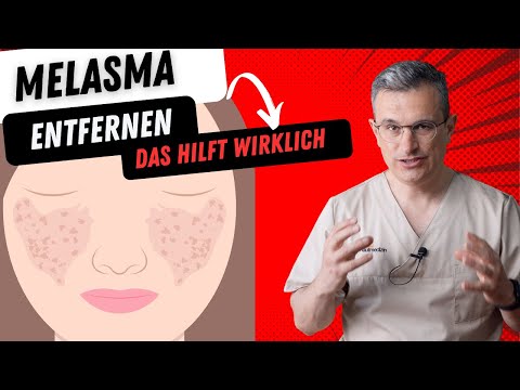 Melasma entfernen, Tipps