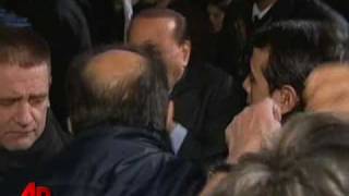 Bandaged Berlusconi Leaves Hospital