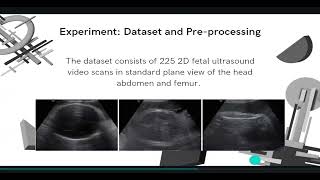 Presentation - BabyNet Residual Transformer Module for Birth Weight Prediction Fetal Ultrasound Vi