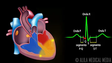 ¿Qué es el sistema de conducción cardiaca?