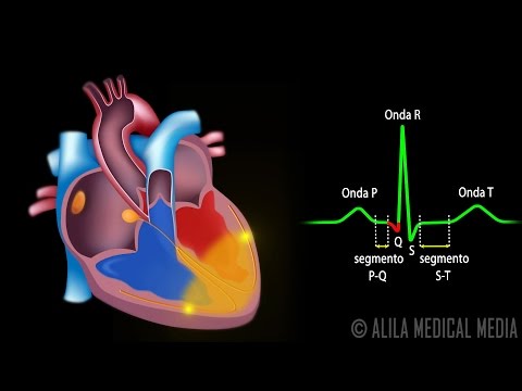 Video: ¿Se contraen los ventrículos cuando se despolarizan?