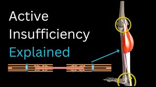 Active Insufficiency Explained Profile