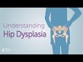 Understanding hip dysplasia  boston childrens hospital