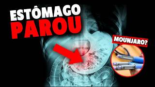 Ela usou Mounjaro para Emagrecer, mas o PIOR aconteceu!