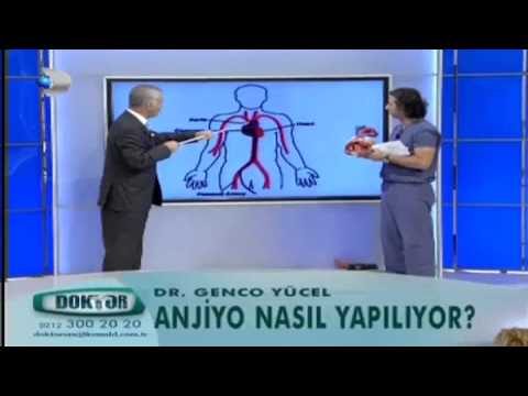 Anjiyo Nasıl Yapılıyor?