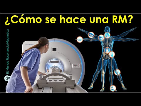 resonancia magnetica El Mundo Resonancia Magnética