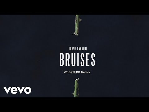 Lewis Capaldi-Bruises (Whitetekk Remix)