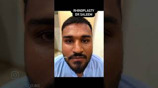 Rhinoplasty surgery for crooked. Nose in Pakistan by dr Saleem