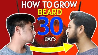 6 Simple Tricks that will help you in growing Beard || Grow beard in 10 days || Trending Fashion