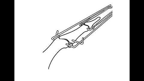 PIP Joint Dislocations and Fracture Dislocations