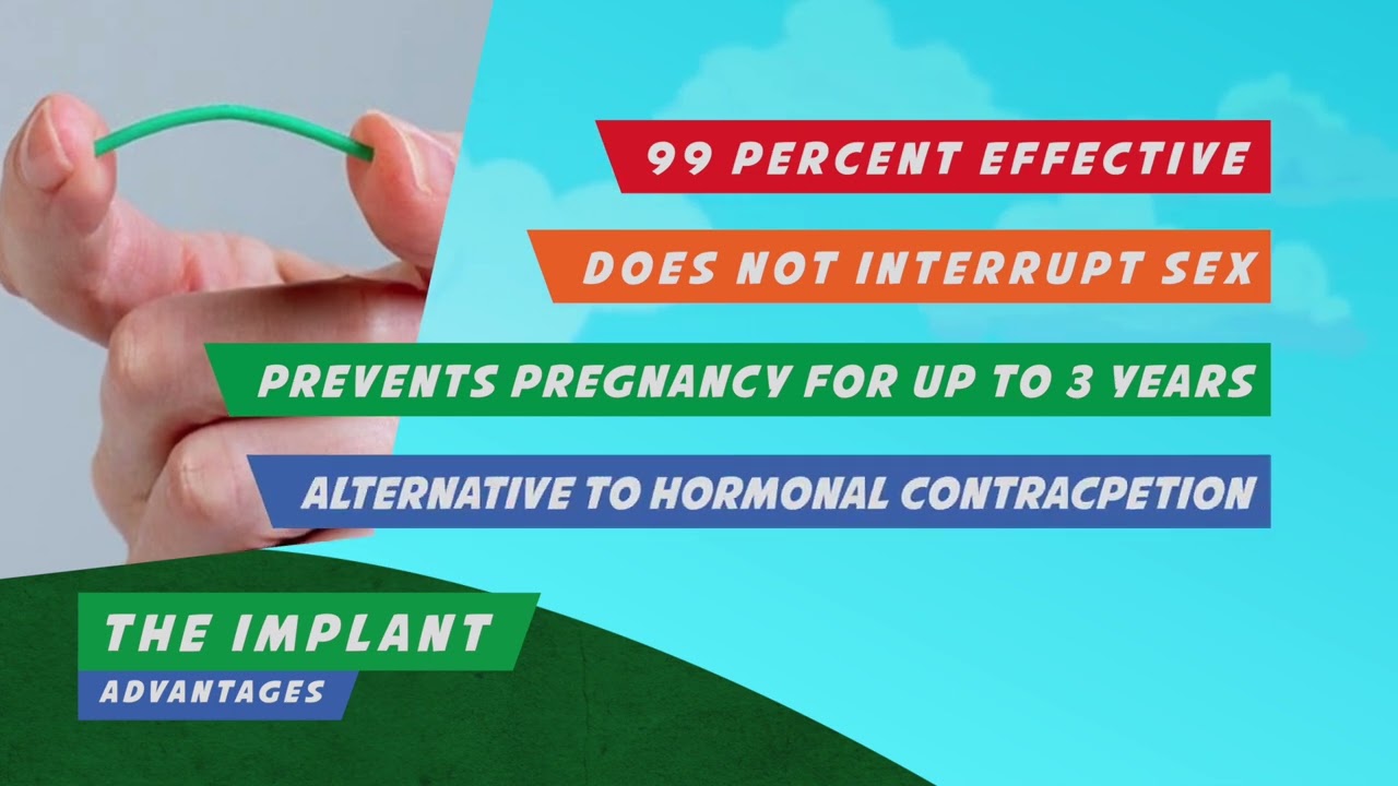 CDDFT CONTRACEPTIVE IMPLANT