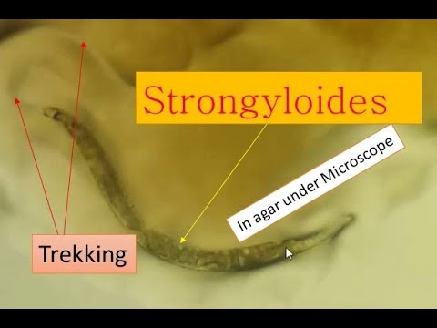 strongyloidosis fertőzés)