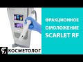 Фракционное омоложение Scarlet RF