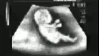 Story wa lucu' anak masih di dalam perut udah bisa nyetir