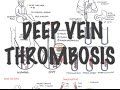 Deep Vein Thrombosis - Overview (pathophysiology, treatment, complications)