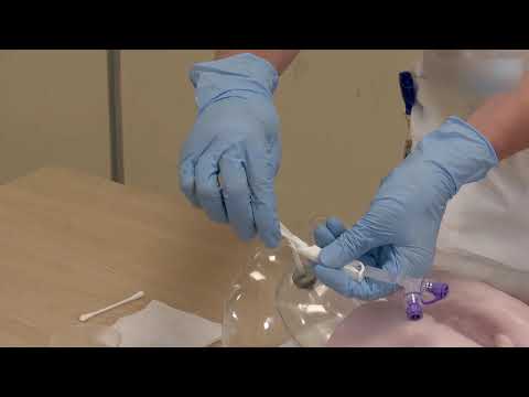 How to Advance and Rotate a Corflo PEG (Percutaneous Endoscopic Gastrostomy)