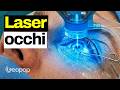 Cosa succede durante l'operazione laser agli occhi? Abbiamo documentato l'esperienza di una paziente