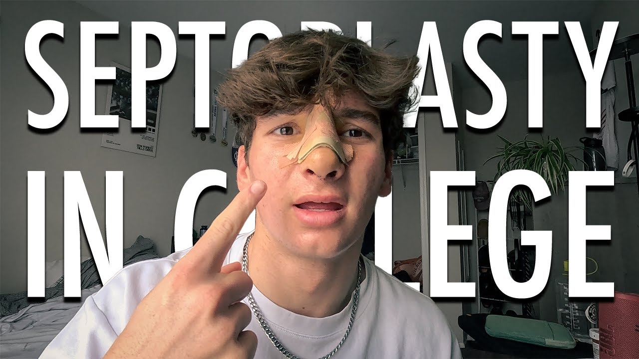 SEPTOPLASTY & recovery while in COLLEGE
