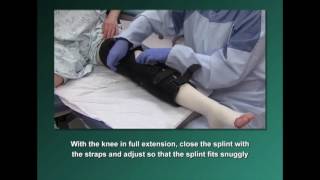 Burns 404: Leg Splints