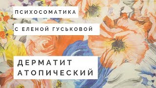 Психосоматика АТОПИЧЕСКИЙ ДЕРМАТИТ Психосоматика АТОПИЧЕСКИЙ ДЕРМАТИТ