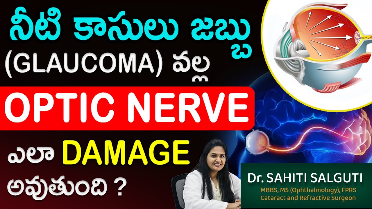 effect on optic nerve telugu గ్లాకోమా Eye pressure