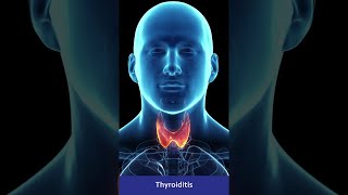 Types of Thyroiditis & Its Symptoms | Practo #Shorts