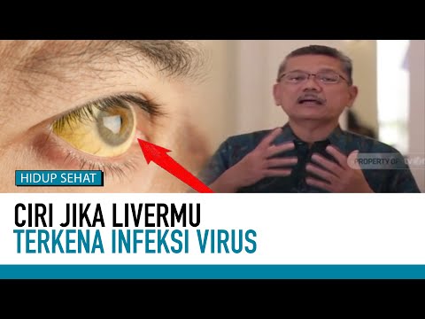 Kenali Tipe dan Gejala Penyakit Hepatitis | Deteksi Penyakit